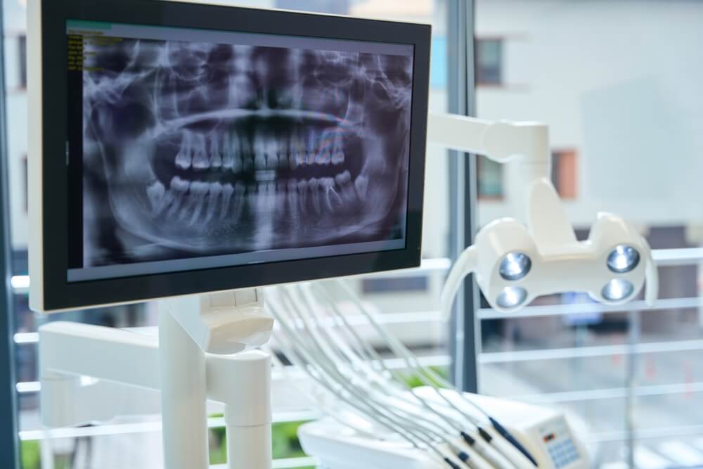 closeup of dental xray displayed on monitor